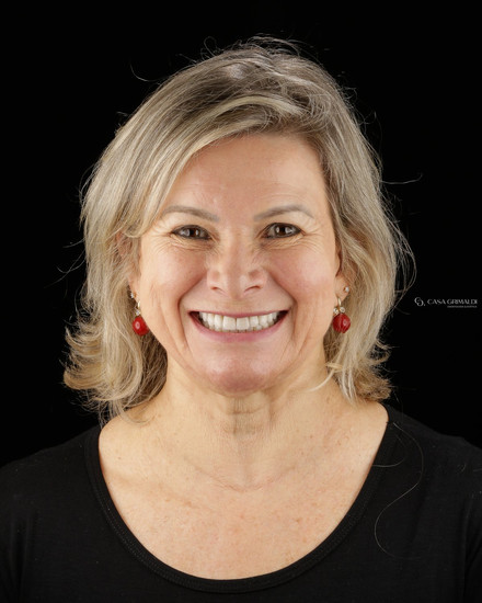 Reabilitação oral em Itapema — sorriso completamente restaurado